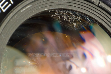 Lens bị mốc: Biểu hiện, nguyên nhân và cách khắc phục
